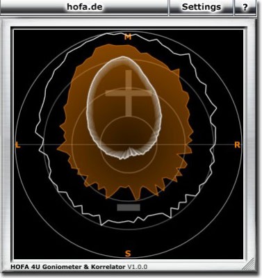 Goniometer &amp; Korrelator